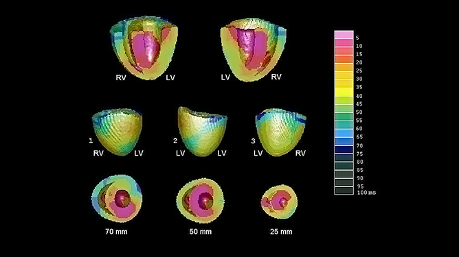 Simulation of biological systems